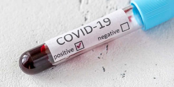 Corona Covid-19 - positives Testergebnis